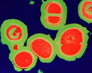 MRSA Bacteria Prints: MRSA resistant Staphylococcus bacteria