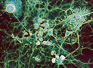 Images Dated 2012 April: Multiple sclerosis Print, SEM image