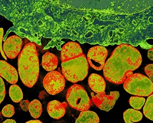 Mycoplasma bacteria, TEM Mycoplasma bacteria, TEM