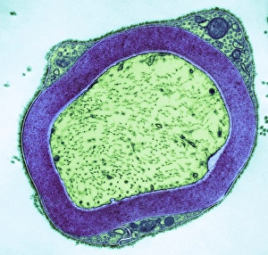 Myelinated Nerve Fibre Print