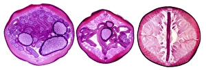 Prints of Nematode worm. Light micrograph of three transverse sections through the body of a female round unsegmented worm (Ascaris lumbricoides) Images Dated 2008 November: Transverse sections of Ascaris lumbricoides Print