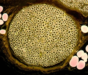 Myelin Sheath Structure Prints: Nerve bundle, light micrograph