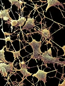 Images Dated 8th December 1999: Nerve cells