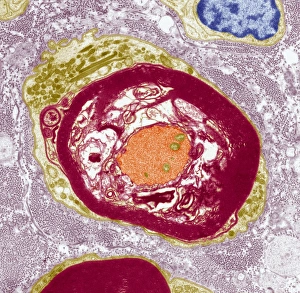Schwann Cell Function Prints: Nerve demyelination, TEM