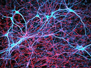 Nerve and glial cells, light micrograph Nerve and glial cells, light micrograph