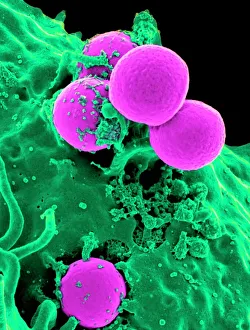 Neutrophil engulfing MRSA, SEM C018/8596 Neutrophil engulfing MRSA, SEM C018/8596