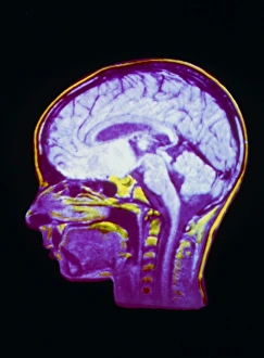 NMR scan of a childs head, sagittal section NMR scan of a childs head, sagittal section