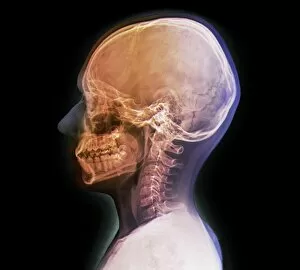 Images Dated 7th January 2016: Normal childs head, X-ray
