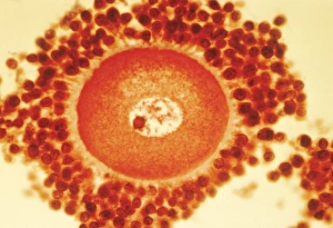 Oocyte in follicle, print