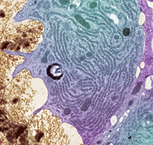 Osteoclast, TEM Osteoclast, TEM