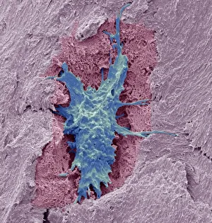 Osteocyte bone cell, SEM C016/9025 Osteocyte bone cell, SEM C016/9025