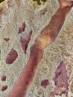 Ovarian tissue, SEM Ovarian tissue, SEM