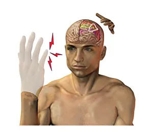 Images Dated 26th October 2012: Phantom Pain Print: A man's amputated hand glows with red light