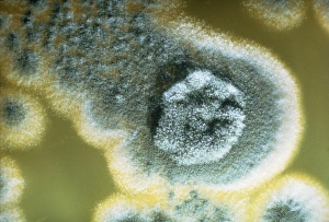 Photomicrograph of Penicillin chrysogenum Photomicrograph of Penicillin chrysogenum