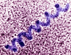 Pigment molecule, TEM Pigment molecule, TEM
