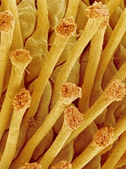 Pistil of a cinquefoil flower, SEM Pistil of a cinquefoil flower, SEM