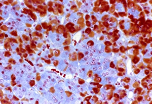 Pituitary gland tissue, light micrograph Pituitary gland tissue, light micrograph