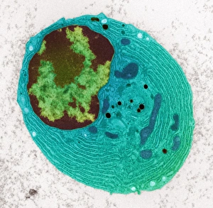 TEM Plasma Cell Print, 10cm wide