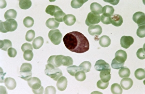 White Blood Cell Types Prints: Plasmocyte blood cell, light micrograph