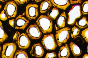 Prints of Plasmodesma plant cells. Light micrograph of a transverse section through intracellular bridges (plasmodema cell) in the fruit of a strychnine plant (Strychnos nux-vomica) Images Dated 2009 October: Plasmodesma Plant Cells Print