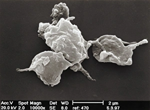 Images Dated 16th January 2003: SEM Platelet Print, 7x9.5 inch, x25,000 magnification