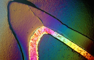 Polarised LM of a cracked ceramic dental crown Polarised LM of a cracked ceramic dental crown