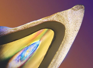 Polarised LM of a tooth with a dental crown Polarised LM of a tooth with a dental crown