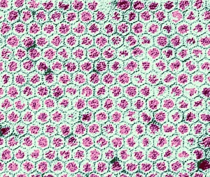 Polio viruses, TEM Polio viruses, TEM