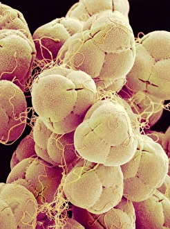 Pollen Grain Structure Prints: Pollen of an azalea, SEM