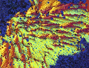 Polarised Light Microscopy Prints: Progesterone hormone, light micrograph