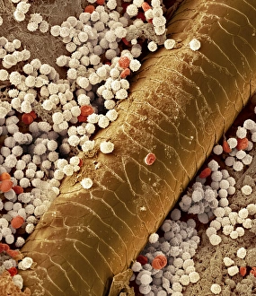 Coloured Scanning Electron Microscopy (SEM) Prints: Pyoderma skin disease, SEM