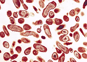 Q fever bacteria, Coxiella burnetii, TEM Q fever bacteria, Coxiella burnetii, TEM