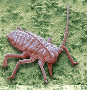 SEM Images Of Insects Prints: Raspberry aphid, SEM C014 / 1430