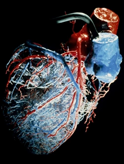 Resin cast of the blood supply to the heart Resin cast of the blood supply to the heart
