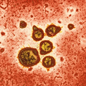 Respiratory syncytial virus, TEM Respiratory syncytial virus, TEM