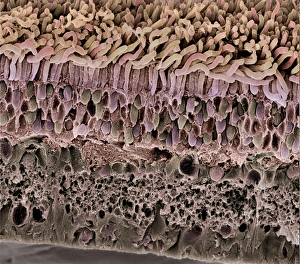 Retina, SEM Retina, SEM