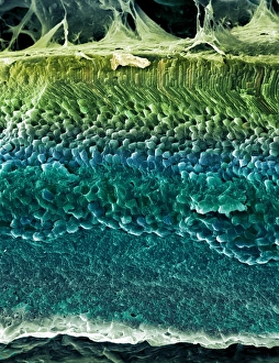Retina Print - Coloured Freeze-Fracture SEM Image