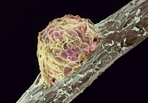 Prints of Root nodule. Coloured scanning electron micrograph (SEM) of a root nodule on a pea plant (Pisum sativum) caused by the nitrogen-fixing soil bacteria Rhizobium leguminosarum Images Dated 2004 October: Coloured SEM of a pea root nodule