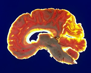 Sagittal slice through a healthy human brain Sagittal slice through a healthy human brain