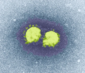 Coloured TEM Images Prints: SARS virus particles, TEM