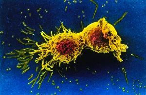 Scanning electron micrograph of cell division Scanning electron micrograph of cell division
