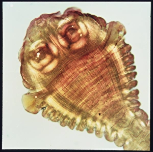 Scolex (head) of a beef tapeworm, Taenia saginata Scolex (head) of a beef tapeworm, Taenia saginata