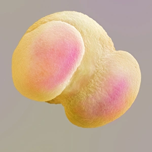 SEM Images Of Pollen Prints: Scots pine pollen grain, SEM