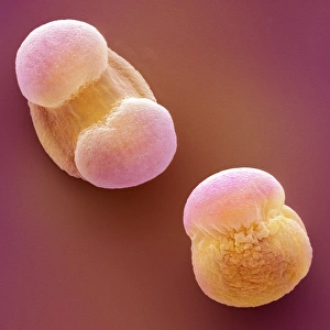 Coloured Scanning Electron Micrograph Prints: Scots pine pollen, SEM