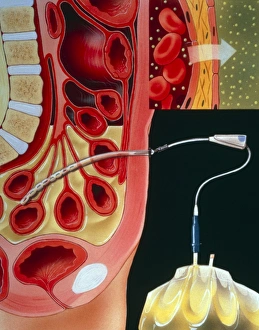 Section through human abdomen Section through human abdomen