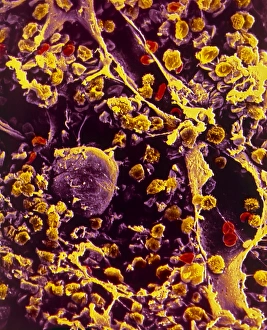Human Body Bone Structure Prints: SEM of bone marrow