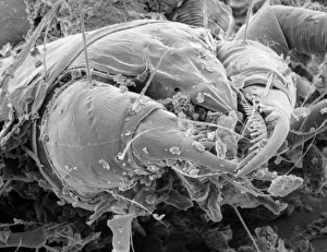 SEM of the dust mite Dermatophagoides sp SEM of the dust mite Dermatophagoides sp
