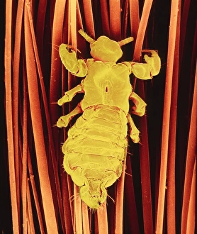 SEM of human head louse SEM of human head louse