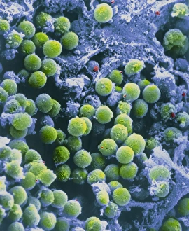 Human Immune System Cells Prints: SEM of lymphocytes in cortex of thymus