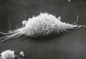 Scanning Electron Micrograph SEM Prints: SEM of a macrophage cell moving over a surface
